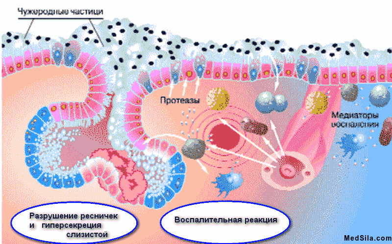 поражение слизистой оболочки дыхательных путей